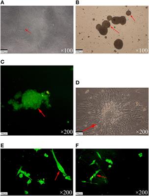 Difference in the Inhibitory Effect of Temozolomide on TJ905 Glioma Cells and Stem Cells